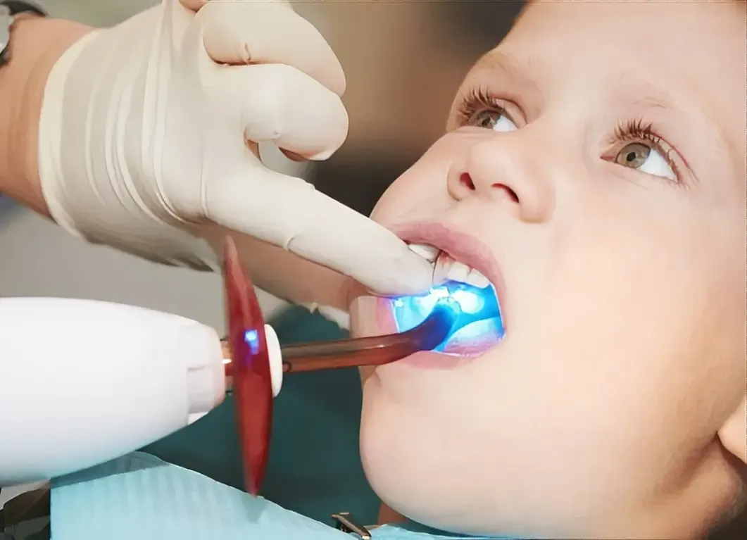 Child Get Dental Sealants